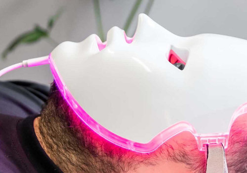 The Power of Google Ads for Aesthetic Clinics: How to Boost Your Business